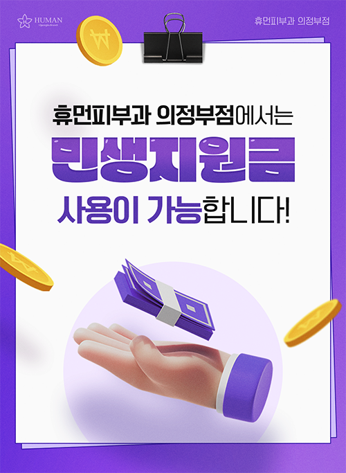 λ